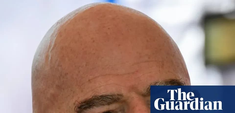 Bald man with prominent eyebrows and serious expression