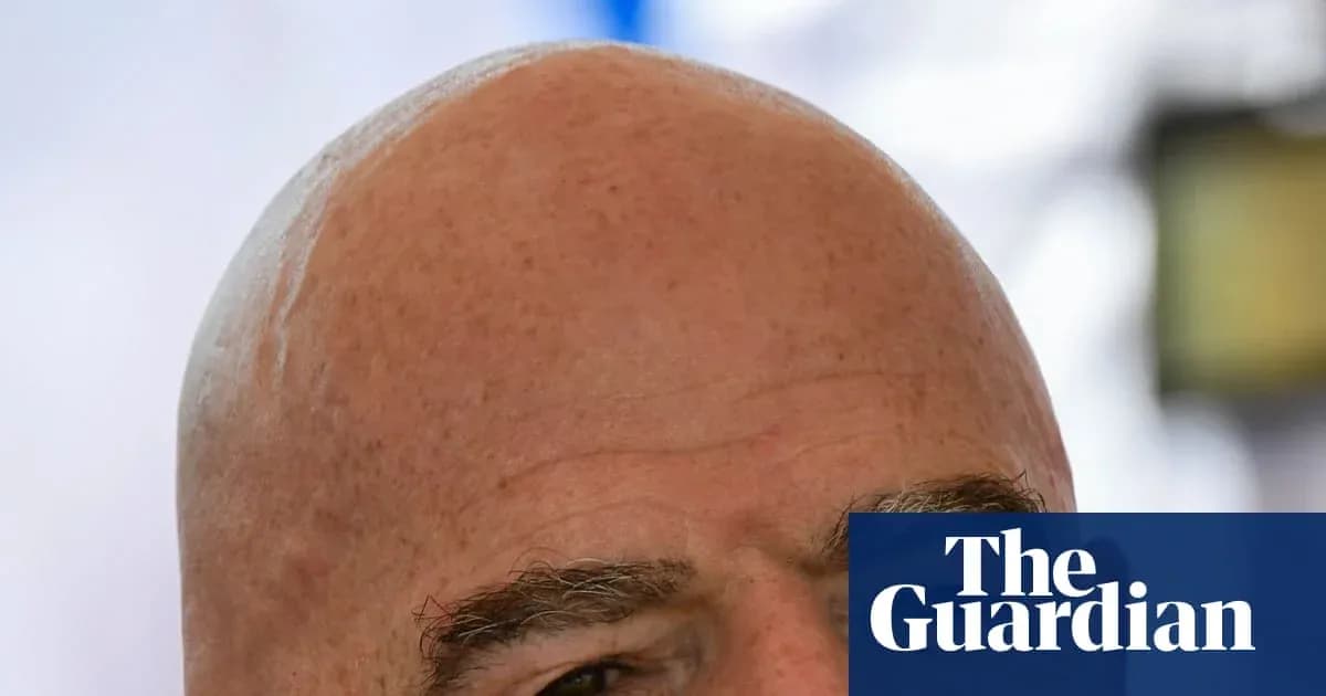 Bald man with prominent eyebrows and serious expression